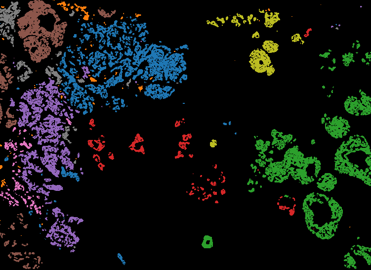 ../_images/notebooks_single-TME_analysis_29_0.png